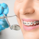 Benefits of Orthodontic Treatment
